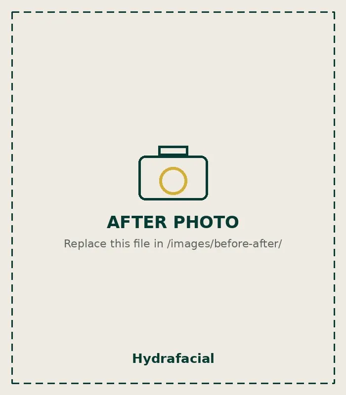 After Facial treatment