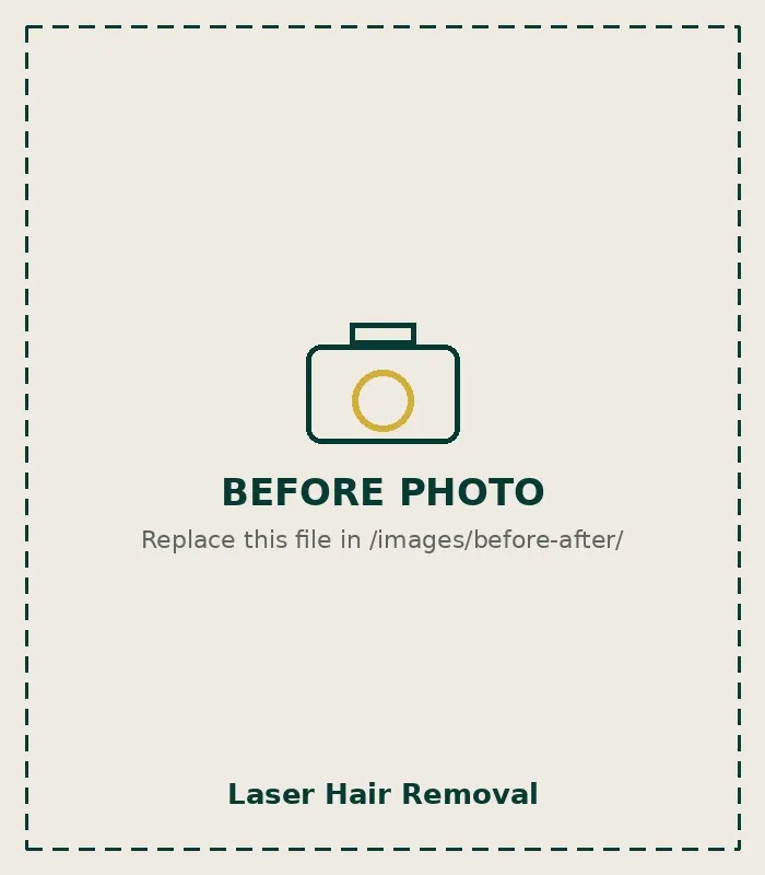 Before Laser Hair Removal