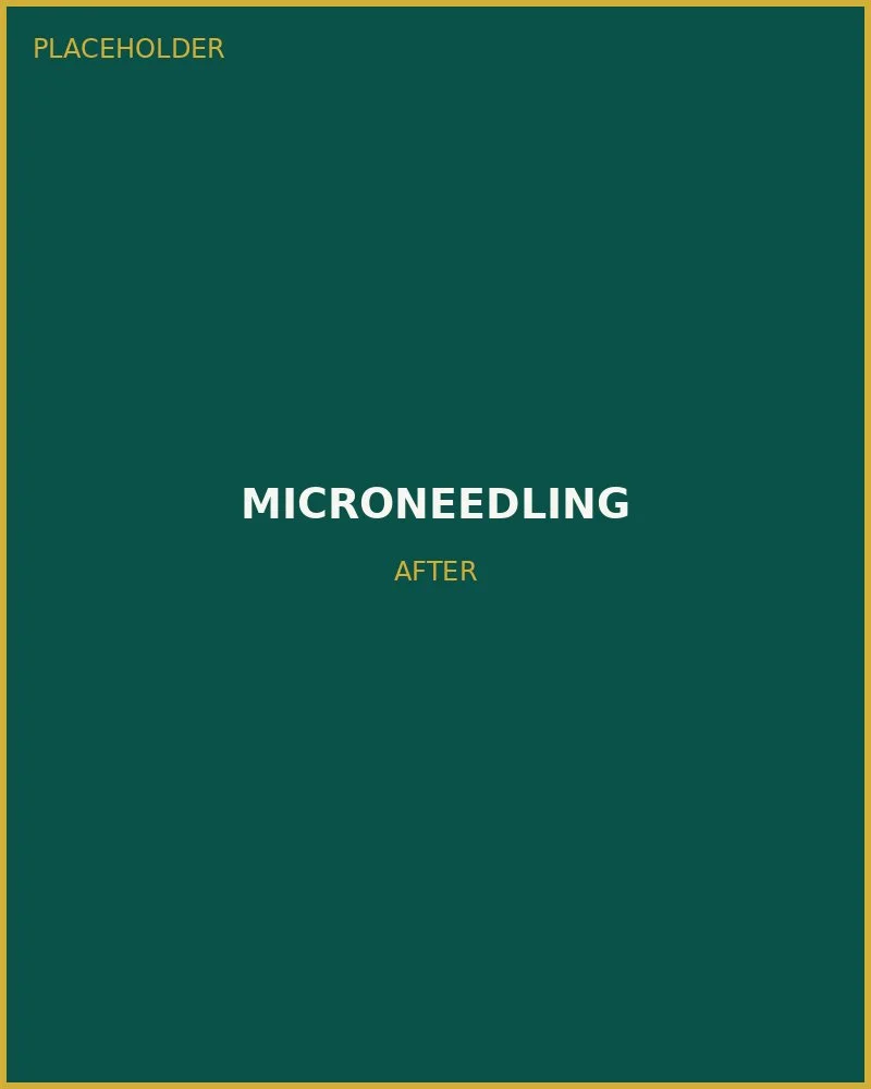After Microneedling
