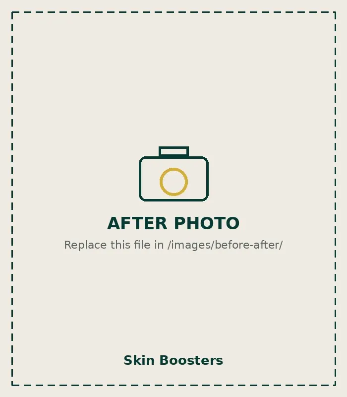 After Skin Boosters