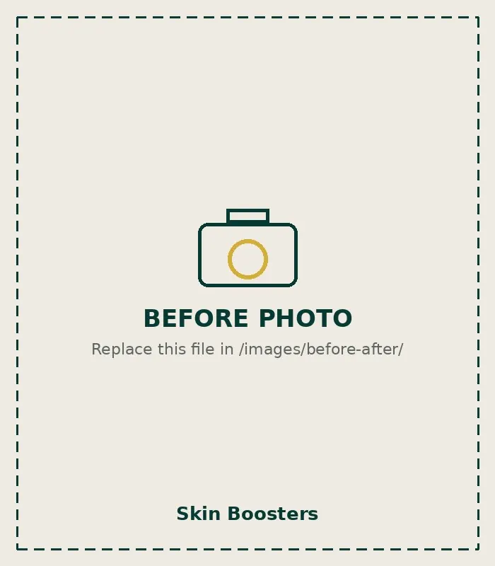 Before Skin Boosters